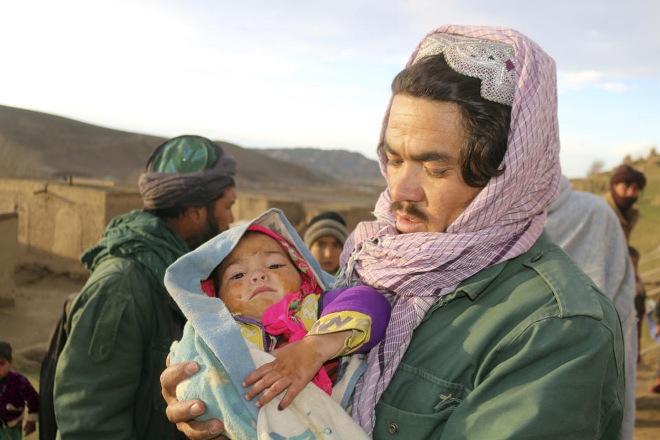 An Afghan man hold his injured daughter after his home was damaged by Monday's earthquake in the remote western province of Badghis, Afghanistan, Tuesday, Jan. 18, 2022. The United Nations on Tuesday raised the death toll from Monday's twin earthquakes in western Afghanistan, saying three villages of around 800 houses were flattened by the temblors. (Abdul Raziq Saddiqi)