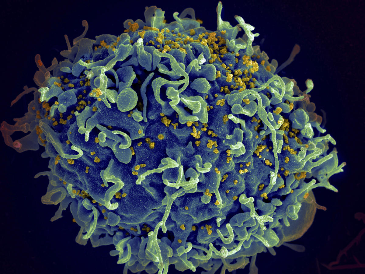 CDC, kozmetik iğneler aracılığıyla bulaşan ilk belgelenen HIV vakalarının tespit edildiğini söyledi