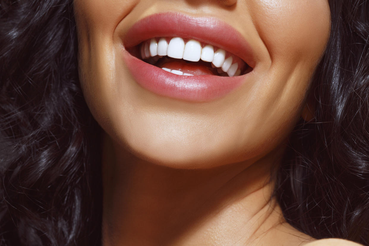 Save on having the bright white smile on your dreams. (Photo: Getty)