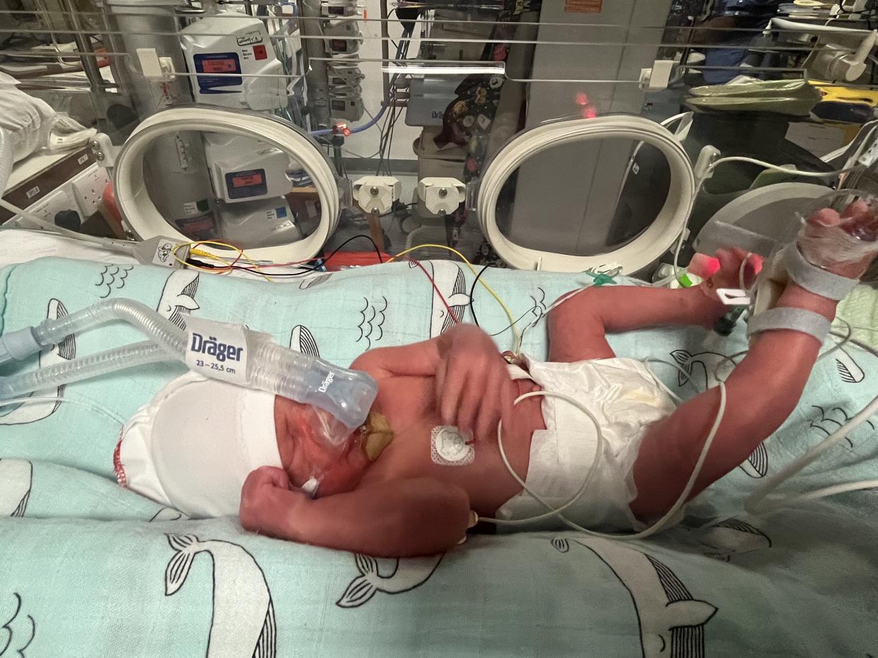 Baby Neo has defied the odds to survive and is now at home with his twin brother. (Corinne Rose/SWNS)