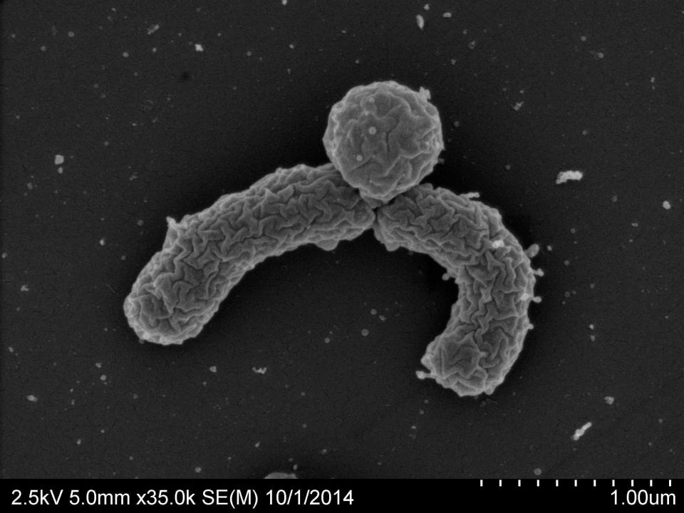 Researchers say Teixobactin is a promising new antibiotic able to kill some superbugs.