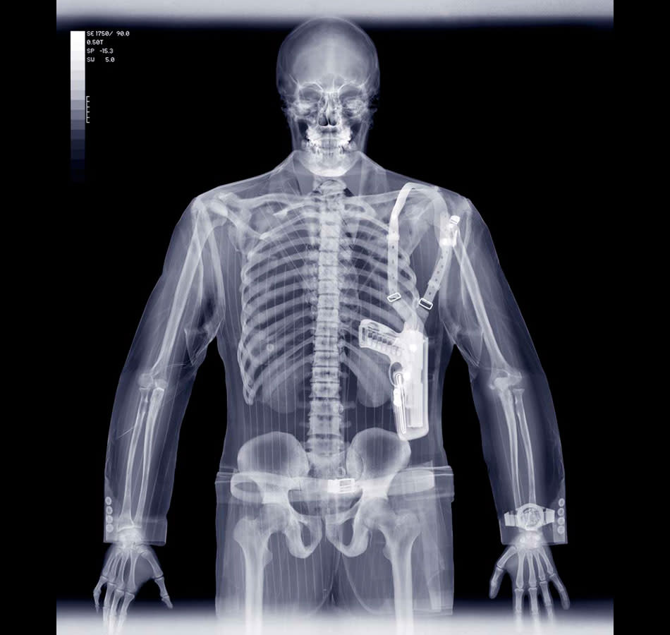 Fascinating X-ray photographs by Nick Veasey svkg 210612