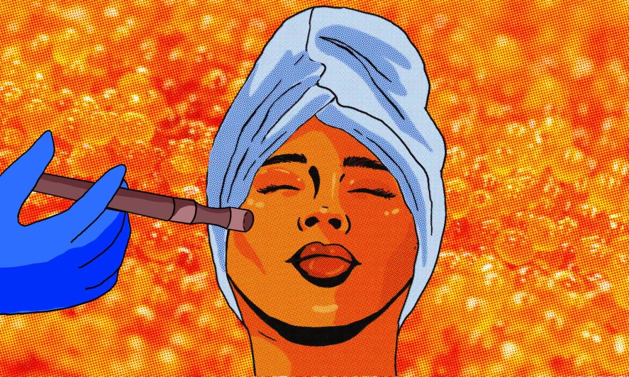 <span>Microneedling is an essential part of the salmon sperm facial experience.</span><span>Illustration: Rita Liu/The Guardian</span>