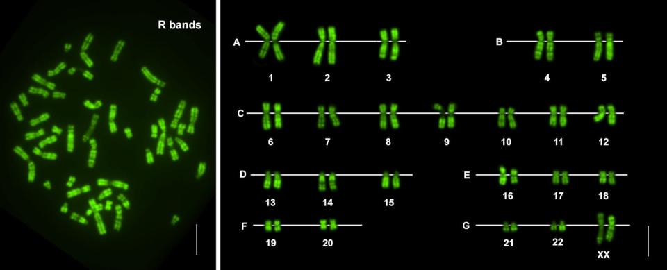 Ejemplo de metafase humana y su correspondiente cariotipo, mostrando los cromosomas marcados con bandas de replicación tardía. Esta técnica de bandeo cromosómico permite identificar y diferenciar cada cromosoma, proporcionando información sobre la estructura y función del genoma humano. Daniel García Souto