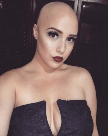 El inspirador mensaje de esta mujer con alopecia conmovió a las redes