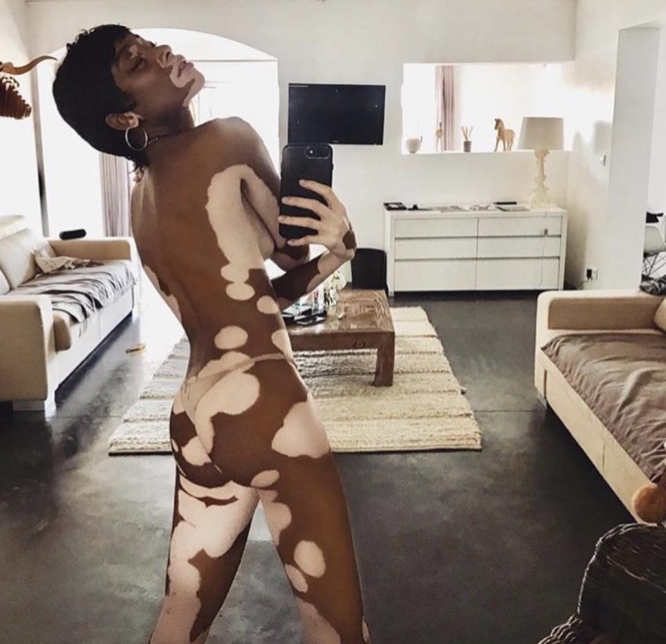 Bild: Instagram.com/winnieharlow