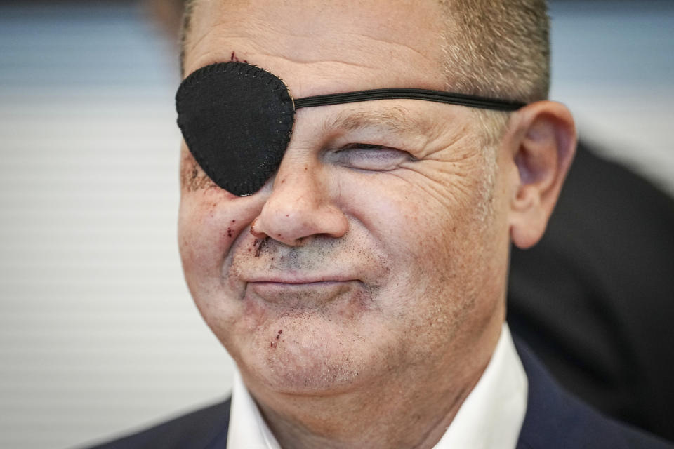 German Chancellor and member of the German Social Democratic Party (SPD), Olaf Scholz, attends his party's federal parliamentary group meeting at the Reichstag building, home of the German federal parliament, Bundestag, in Germany, Monday, Sept. 4, 2023. German Chancellor Olaf Scholz has tweeted a pirate-style picture of himself with a black eye patch and dark-red bruises on the right side of his face — the result of a jogging accident on the weekend. The chancellor wrote Monday in the caption of the photo that he was “excited to see the memes.” (Kay Nietfeld/dpa via AP)
