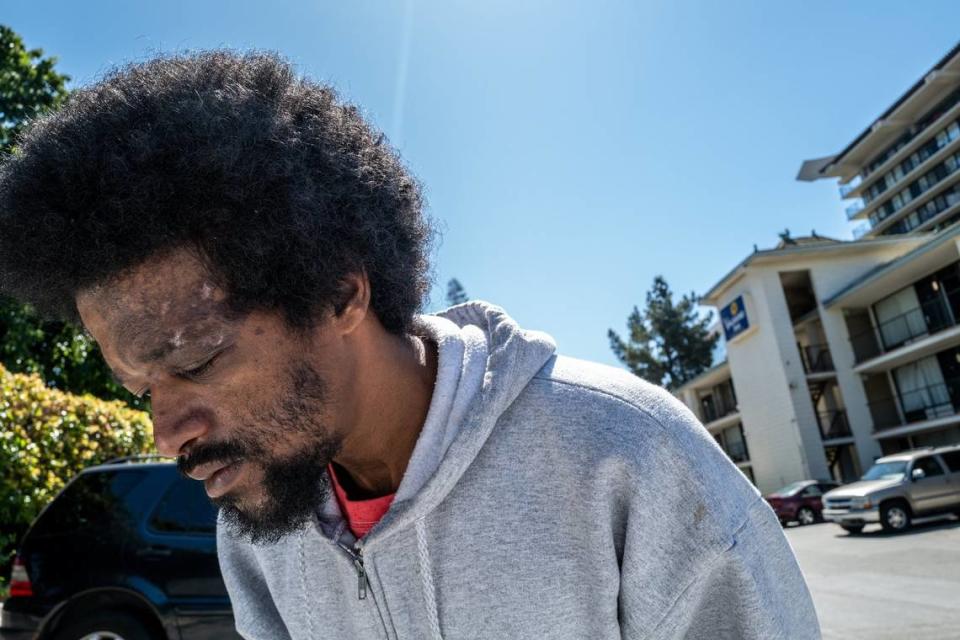 Project Roomkey participant Richard Washington, 34, stands outside the Vagabond Inn motel in Sacramento on Wednesday. He said he is stressed about where he will go when the program at the motel closes at the end of June. Washington, who is recovering from a bout of shingles above his eye, has lived at the hotel since September.