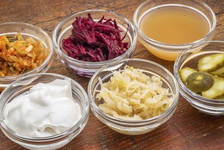 <span class="caption">Probiotic bacteria are found in fermented foods.</span> <span class="attribution"><a class="link " href="https://www.shutterstock.com/download/confirm/486286906?src=zqRmphGy9apVidYjjM3H2w-1-40&size=medium_jpg" rel="nofollow noopener" target="_blank" data-ylk="slk:marekuliasz/Shutterstock.com;elm:context_link;itc:0;sec:content-canvas">marekuliasz/Shutterstock.com</a></span>