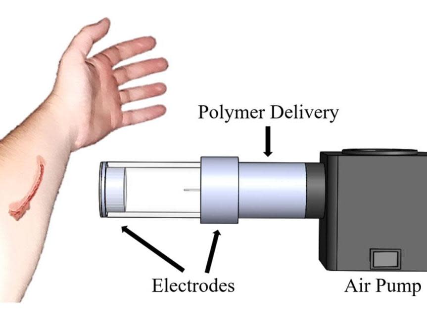 The device (artist's impression) uses air to spray fibres (polymer) onto the surface of the skin, similar to a can of spray paint: MTU