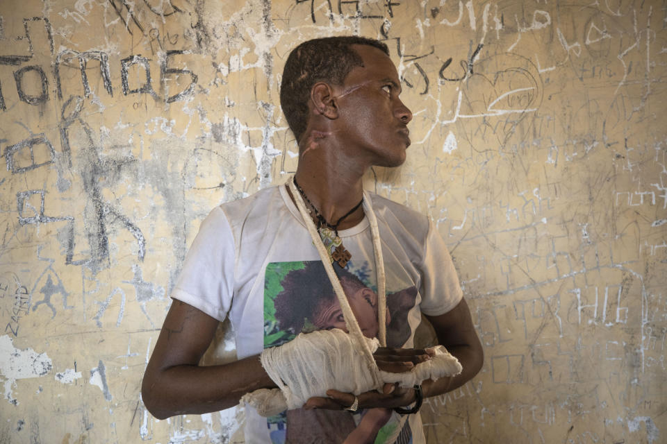 FILE - Ethnic Tigrayan survivor Abrahaley Minasbo, 22, from Mai-Kadra, Ethiopia, shows wounds from machetes he says were inflicted by a pro-government militia on Nov. 9, inside a shelter in Hamdeyat Transition Center near the Sudan-Ethiopia border, in eastern Sudan on Dec. 15, 2020. A year after war began there, the findings of the only human rights investigation allowed in Ethiopia's blockaded Tigray region will be released Wednesday, Nov. 3, 2021. (AP Photo/Nariman El-Mofty, File)