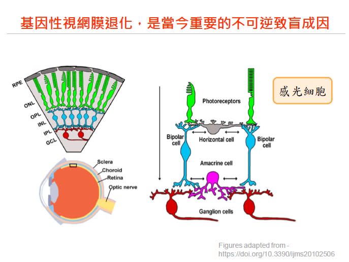 視網膜退化是重要的不可逆致盲成因。（圖／台大醫院提供）