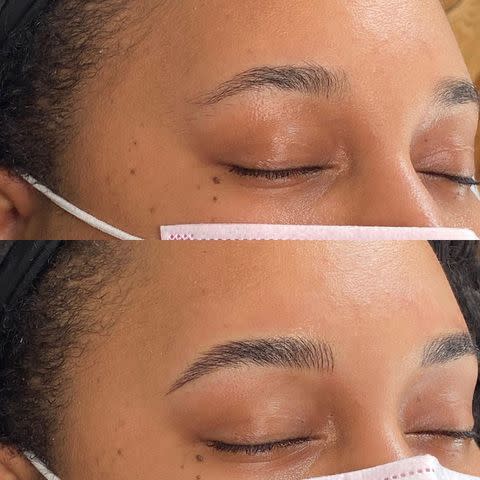 <p><a href="https://www.instagram.com/browstress/" data-component="link" data-source="inlineLink" data-type="externalLink" data-ordinal="1">@browstress</a></p> Microblading Before and After