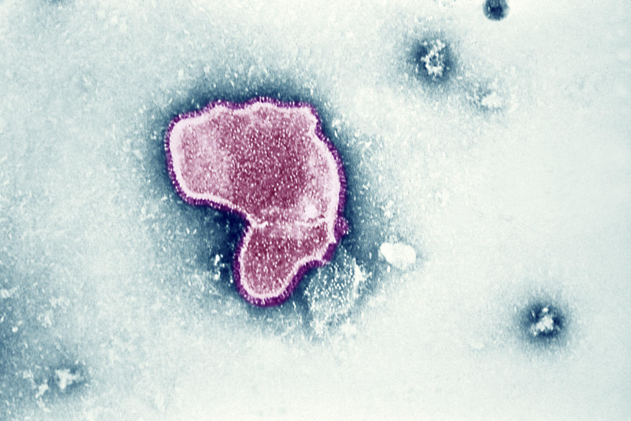An electron micrograph of respiratory syncytial virus.