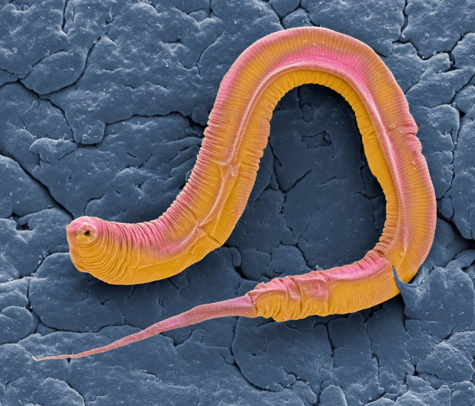 Un Caenorhabditis elegans.