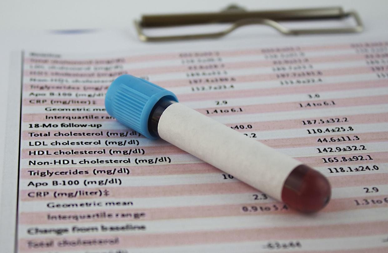 cholesterol and blood test results in laboratory.