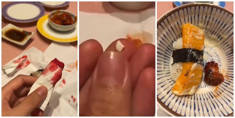  廣東中山一名女子光顧當地一間日式料理店，吃壽司時咬到異物，導致口腔被刮傷流血，店方及後賠償一千元人民幣達成和解。(影片截圖)