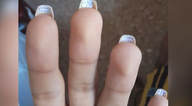 The student taped answers under her nails. Source: Reddit