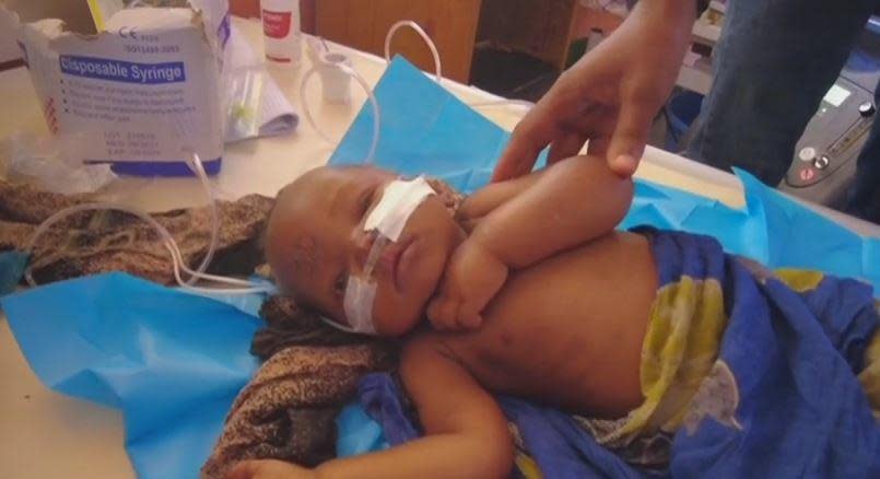 Malyun, 2, struggles to breathe as her body, bloated from severe malnutrition, succumbs to septic shock at a hospital in Baidoa, Somalia, amid a widespread hunger crisis fueled by climate change-induced drought, November 2022.  / Credit: CBS News