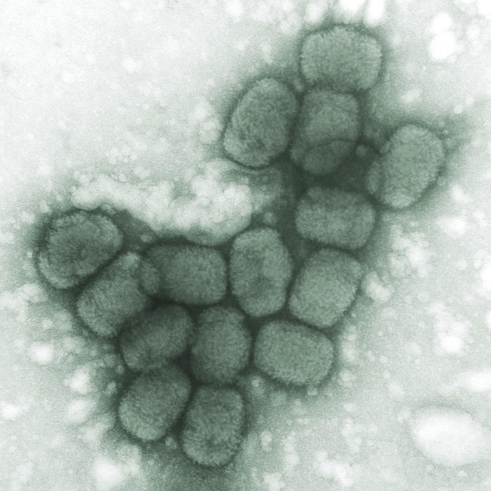 Una imagen de microscopio de virus de la viruela, publicada en 1975 por el Centro de Control y Prevención de Enfermedades de EEUU. (Fred Murphy/CDC via AP)