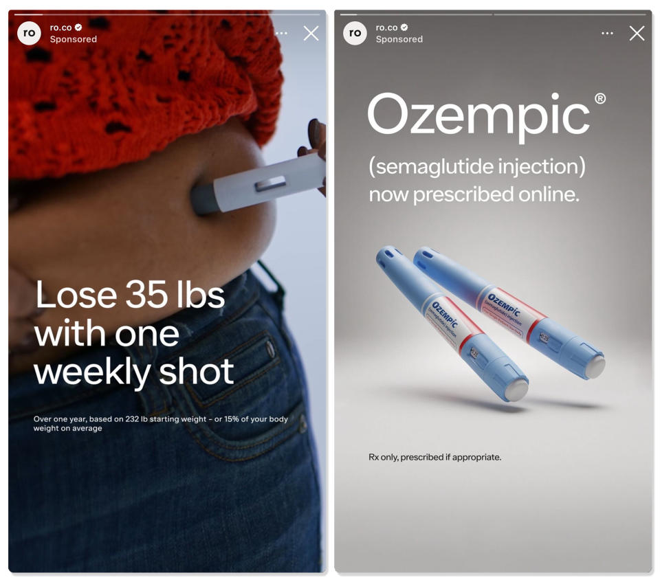 Two Instagram ads for the drug Ozempic (@ro.co via Instagram)
