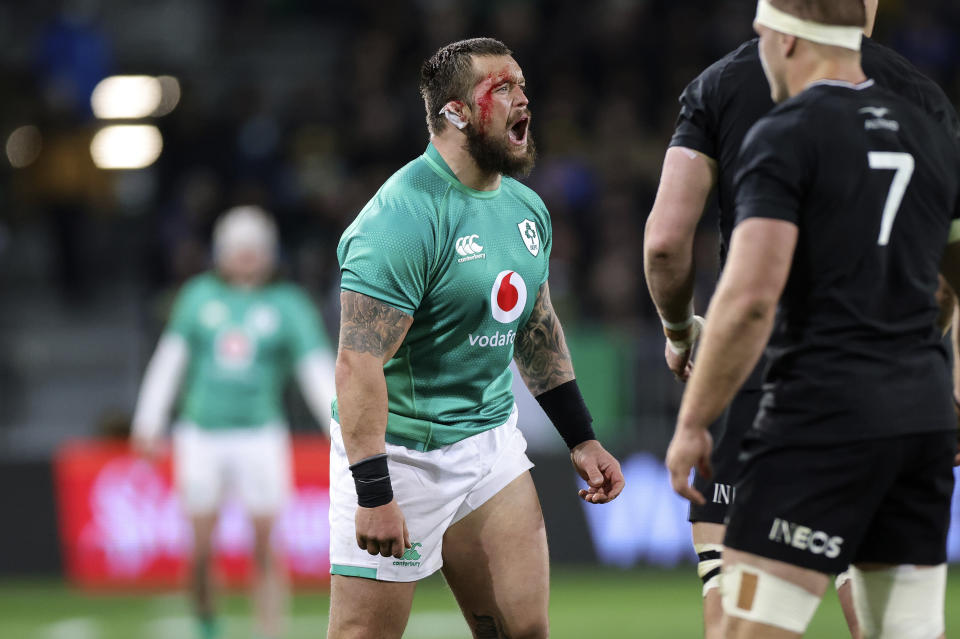 Andrew Porter of Ireland, left, bleeds from a head injury while playing New Zealand in their second rugby union international match in Dunedin, New Zealand, Saturday, July 9, 2022. (Andrew Cornaga/Photosport via AP)