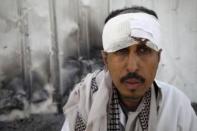 A man sits outside his house with a head injury following a Saudi-led air strike, which destroyed his house, in Yemen's capital Sanaa September 5, 2015. REUTERS/Mohamed al-Sayaghi