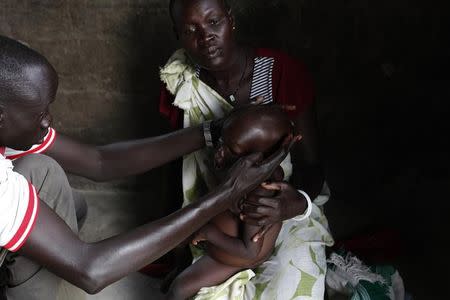 A medical staff attends to a severely malnourished child at the Medecins Sans Frontieres (Doctors Without Borders, MSF) feeding centre in Leer, Unity State, July 16, 2014. REUTERS/Andreea Campeanu/Files
