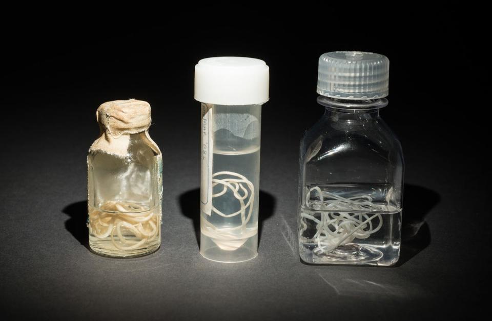 Guinea worm specimens