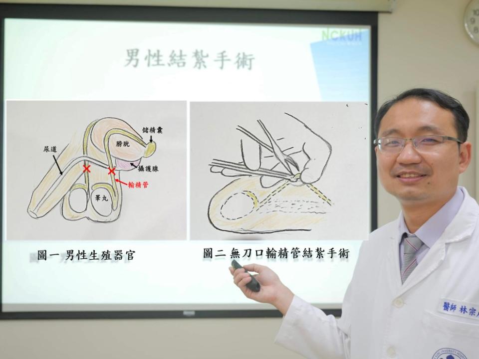 男性結紮後的第二春，成大醫院斗六分院就可做顯微輸精管重建手術。（記者劉春生攝）