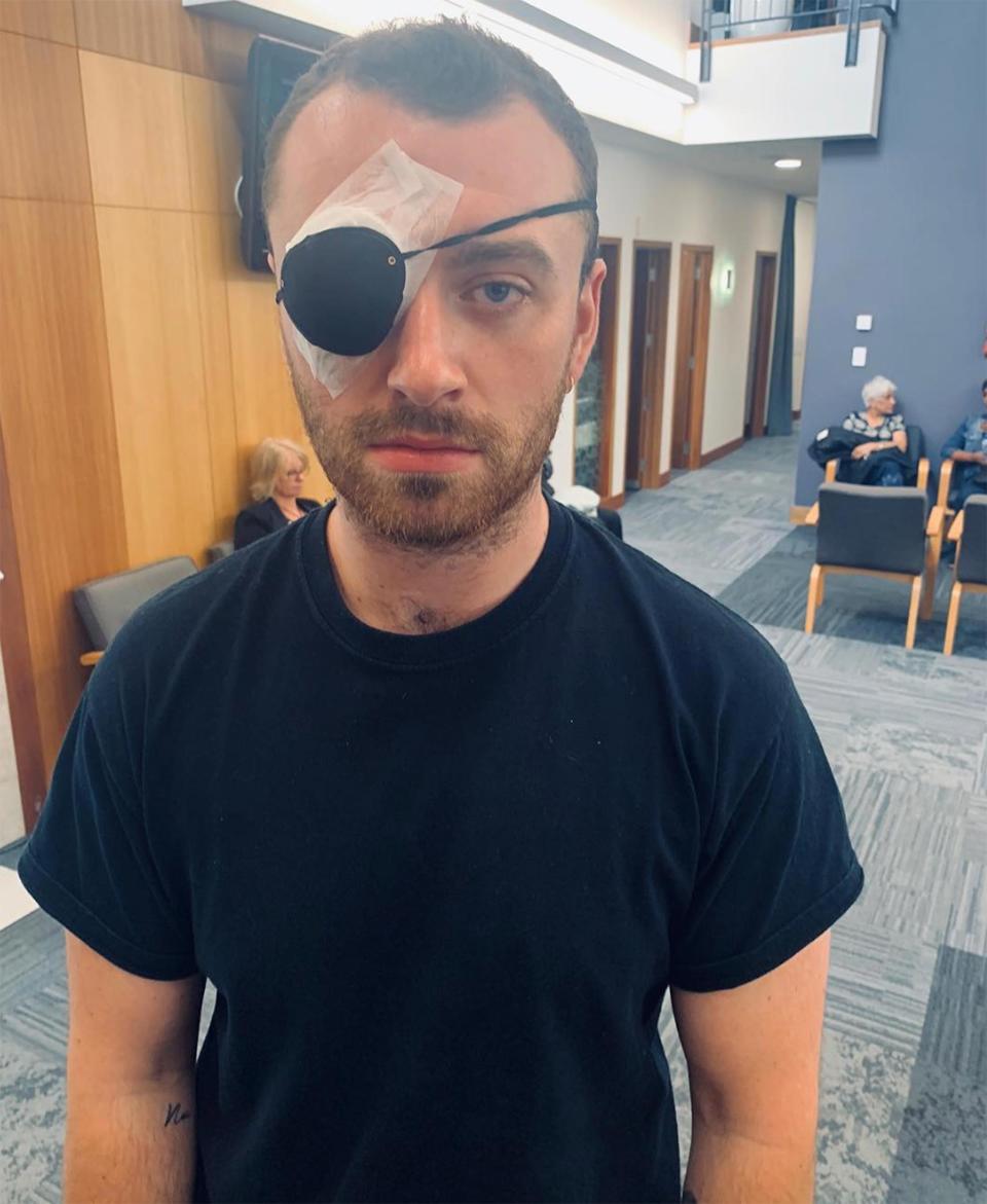 Sam Smith Has Eye Surgery After Suffering from a Stye