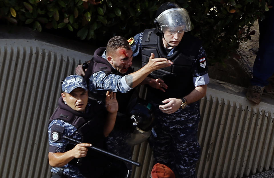 An injured police officer shouts during a protest in Beirut, Lebanon, Monday, May 20, 2019, as the government faces a looming fiscal crisis. Over one hundred protesters gathered Monday outside the Government House in downtown Beirut shouting "Thieves, thieves!" as the Cabinet met for its 16th session to reach agreement on controversial budget cuts. (AP Photo/Bilal Hussein)