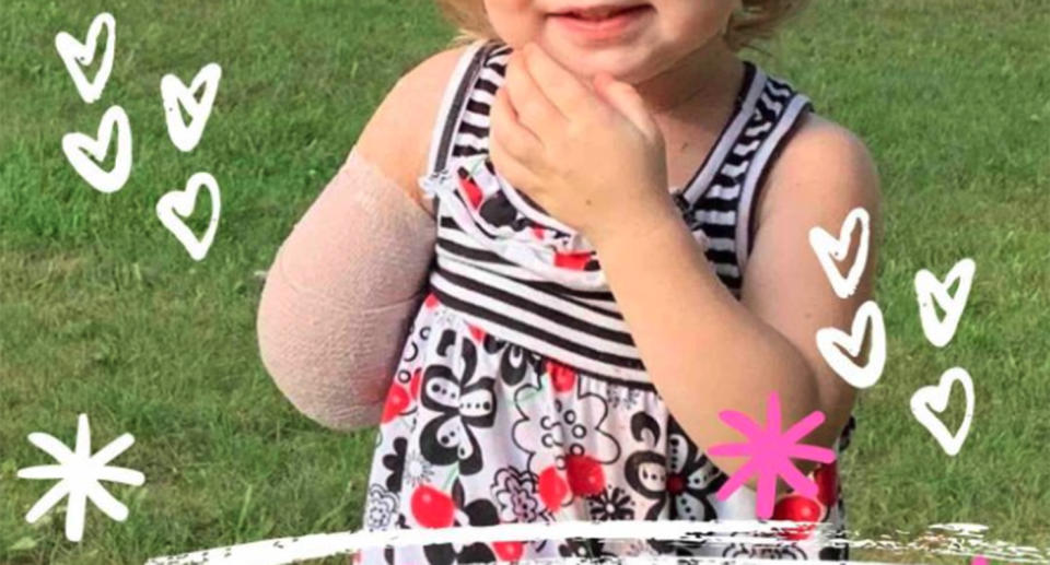 A photo of two-year-old Sophia, who was attacked by a wolf-dog hybrid and lost the lower part of her arm. 