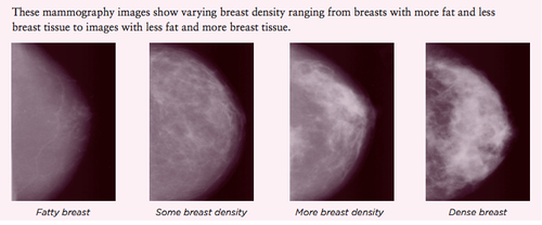 Dense breast' definition varies widely