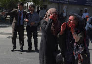 <p>Wounded Afghan women and men gesture at the site of a car bomb attack in Kabul on May 31, 2017.<br> At least 40 people were killed or wounded on May 31 as a massive blast ripped through Kabul’s diplomatic quarter, shattering the morning rush hour and bringing carnage to the streets of the Afghan capital. (Photo: Shah Marai/ AFP/Getty Images) </p>