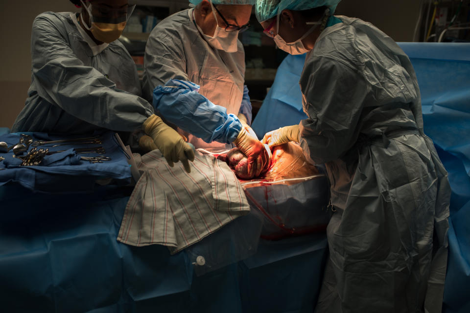 "This cesarean birth was in March 2020, just days before the hospitals shut out all doulas and birth photographers [because of COVID-19]. Her baby was in a breech position and a cesarean birth was scheduled."