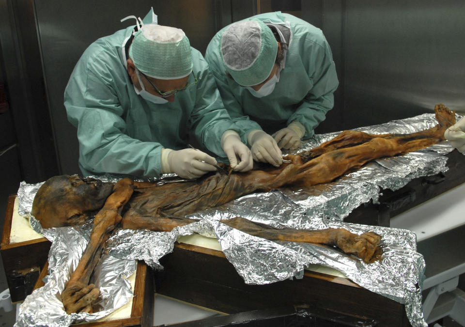 En esta foto de noviembre de 2010 provista por el Museo de Arqueología del Tirol, los investigadores examinan el cuerpo de un cazador de hace 5.300 años conocido como Oetzi, el Hombre de Hielo. (Marco Samadelli/Eurac/South Tyrol Museum of Archaeology via AP)