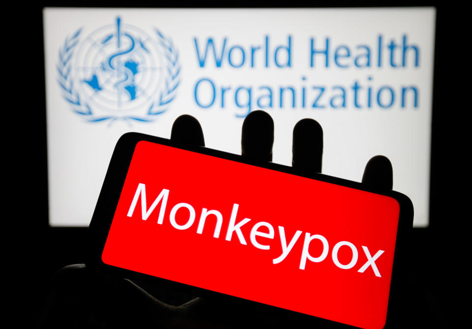 UKRAINE - 2022/05/21: In this photo illustration, the word Monkeypox is seen on the screen of a smartphone with the World Health Organization (WHO) logo in the background. (Photo Illustration by Pavlo Gonchar/SOPA Images/LightRocket via Getty Images)