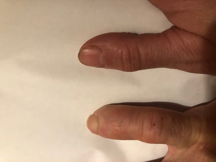 <span class="article__caption">The authors pinky finger (lower finger) compared to his wife’s thumb. Sorry Matt, you’ll never be a hand model.</span> (Photo: Matt Samet)