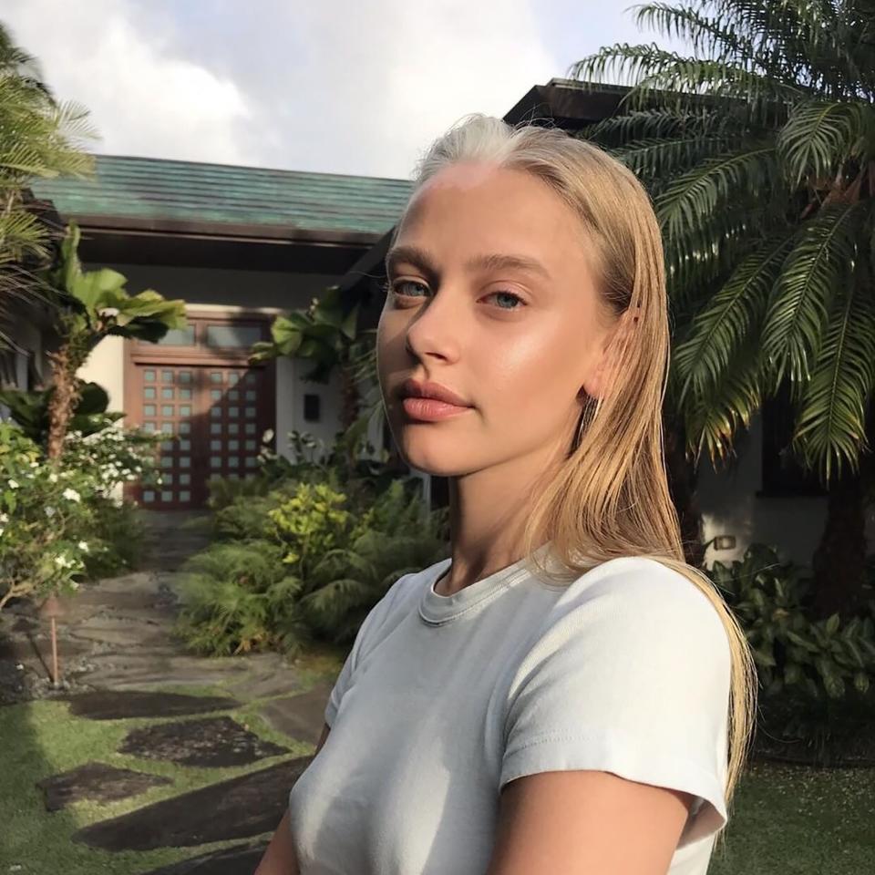 Porcelain skin, clear blue eyes, and a striking white streak on her forehead and in her hair: Meet Tia Jonsson, the 21-year-old model who embraces her vitiligo.