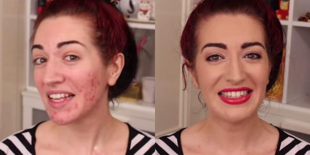 acne before and after makeup