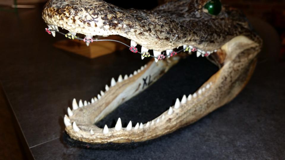 <p><span>Krokodile sind dafür bekannt, dass sie viele und vor allem starke Zähne haben. Was aber kaum jemand weiß: Auch die gefährlichen Reptilien tragen Zahnspangen und wenn sie das nicht machen, haben sie ein so mickriges Gebiss wie auf dem Foto. Jetzt muss man mit der Spange auch nicht mehr anfangen! (Foto: Reddit, MrSomeWhatOkay)</span> </p>