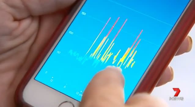 The Fitbit showed Mick's heartbeat to be very irregular. Photo: 7 News