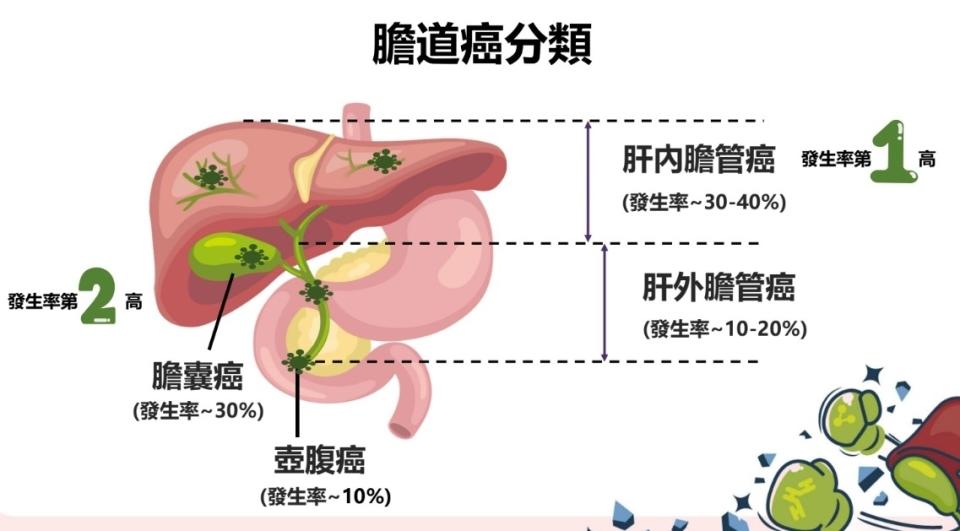 膽道癌有哪些分類？