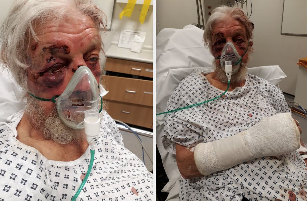 The pensioner suffered serious injuries following the 'nonsensical' attack (Met Police)
