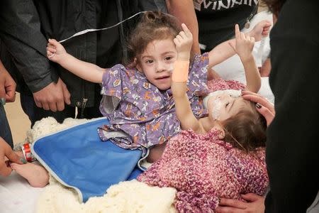 Conjoined twins Erika and Eva Sandoval are shown before their separation surgery December 6, 2016 at Lucile Packard Children’s Hospital Stanford in Palo Alto California, U.S. in this handout photo released to Reuters December 8, 2016. David Hodges/Lucile Packard Children’s Hospital Stanford /Handout via Reuters