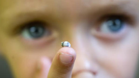 Un caracol brotó de la rodilla del niño Paul Franklin.