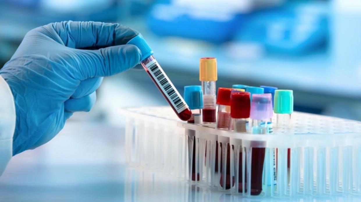 <a href="https://www.shutterstock.com/es/image-photo/how-deal-blood-sample-1805240662" rel="nofollow noopener" target="_blank" data-ylk="slk:Ebrahim Lotfi/Shutterstock;elm:context_link;itc:0;sec:content-canvas" class="link ">Ebrahim Lotfi/Shutterstock</a>