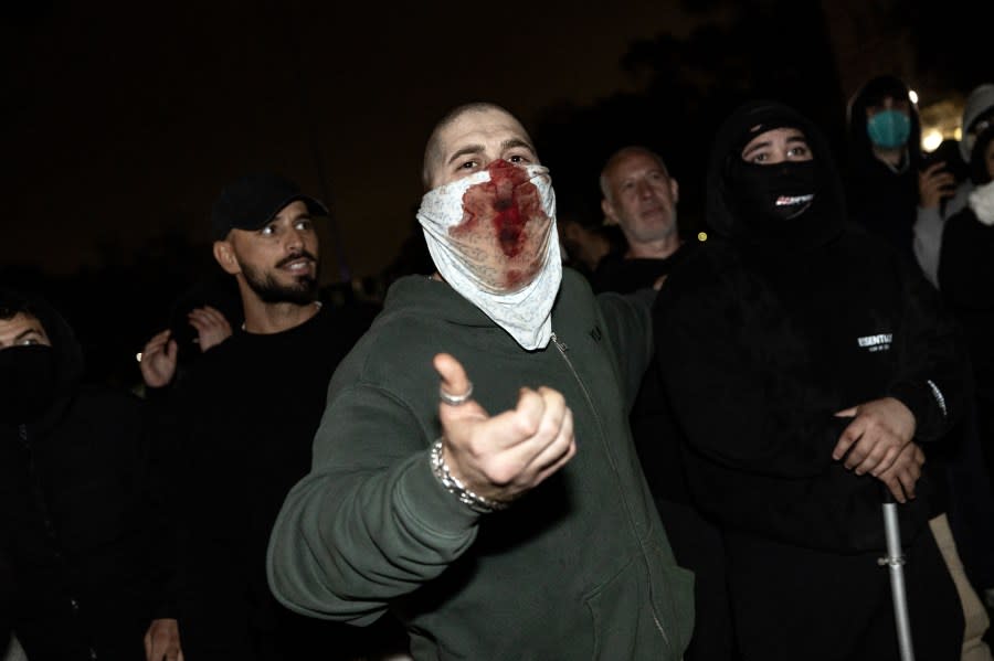 A counter protester shouts at pro-Palestinian protesters at a pro-Palestinian encampment set up on the campus of the University of California Los Angeles (UCLA) as clashes erupt, in Los Angeles on May 1, 2024. Clashes broke out on May 1, 2024 around pro-Palestinian demonstrations at the University of California, Los Angeles, as universities around the United States struggle to contain similar protests on dozens of campuses. (Photo by ETIENNE LAURENT / AFP) (Photo by ETIENNE LAURENT/AFP via Getty Images)