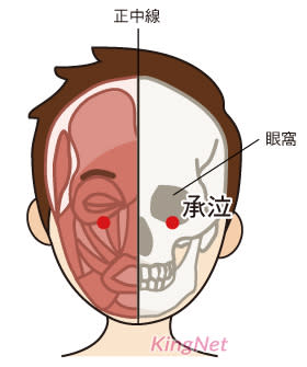 穴位按摩承泣穴